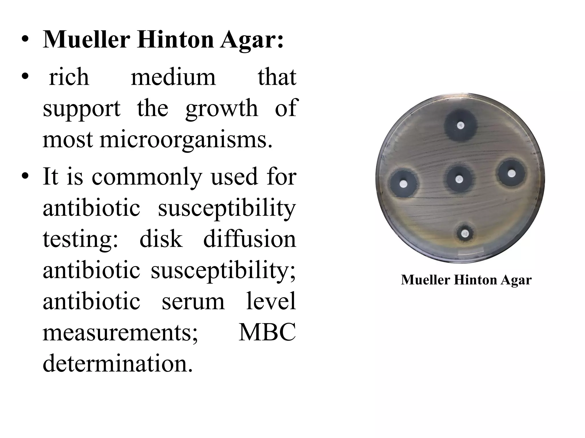 • Mueller Hinton Agar:
• rich medium that
support the growth of
most microorganisms.
• It is commonly used for
antibiotic susceptibility
testing: disk diffusion
antibiotic susceptibility;
antibiotic serum level
measurements; MBC
determination.
Mueller Hinton Agar
 