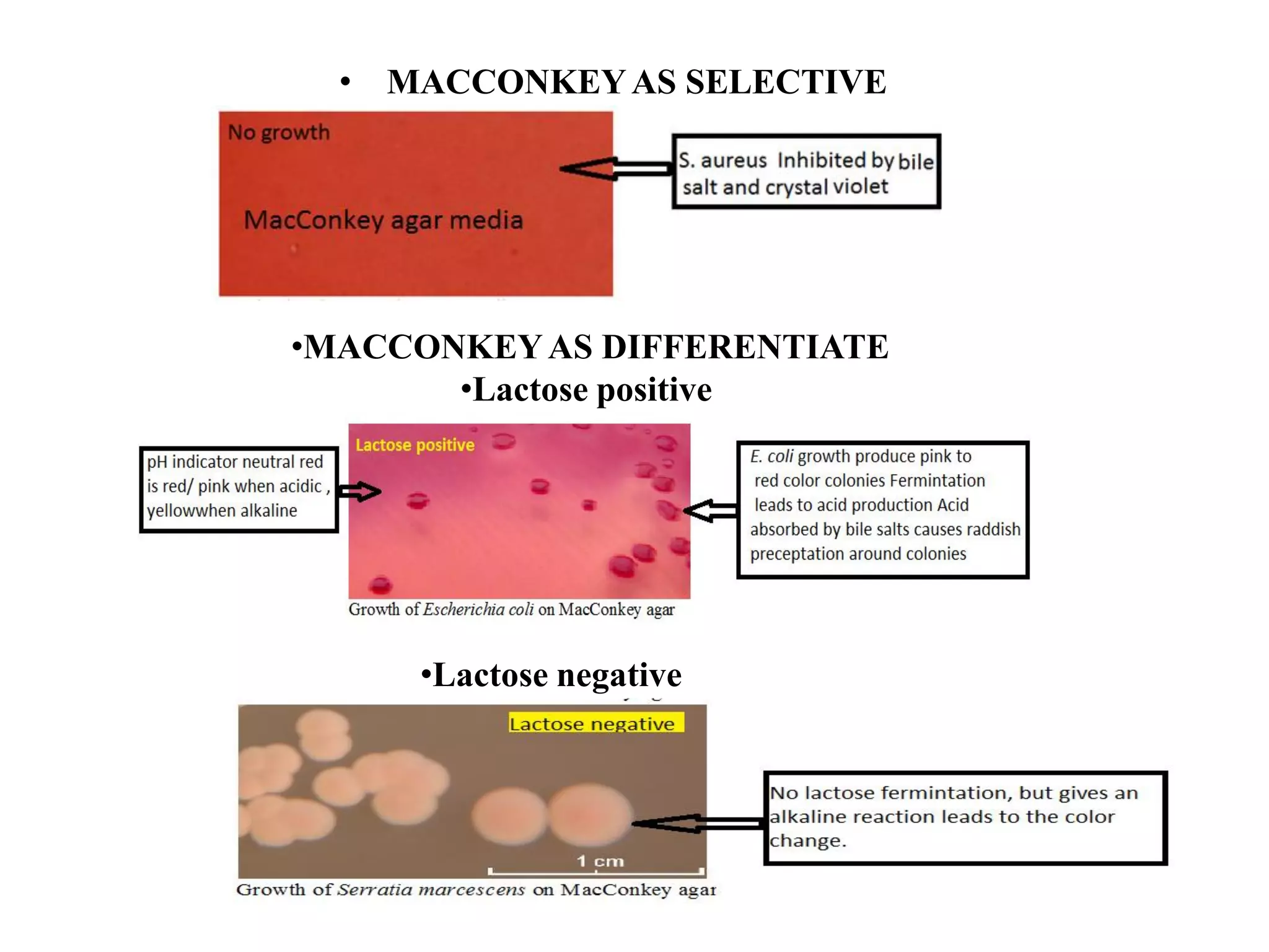 • MACCONKEYAS SELECTIVE
•MACCONKEYAS DIFFERENTIATE
•Lactose positive
•Lactose negative
 