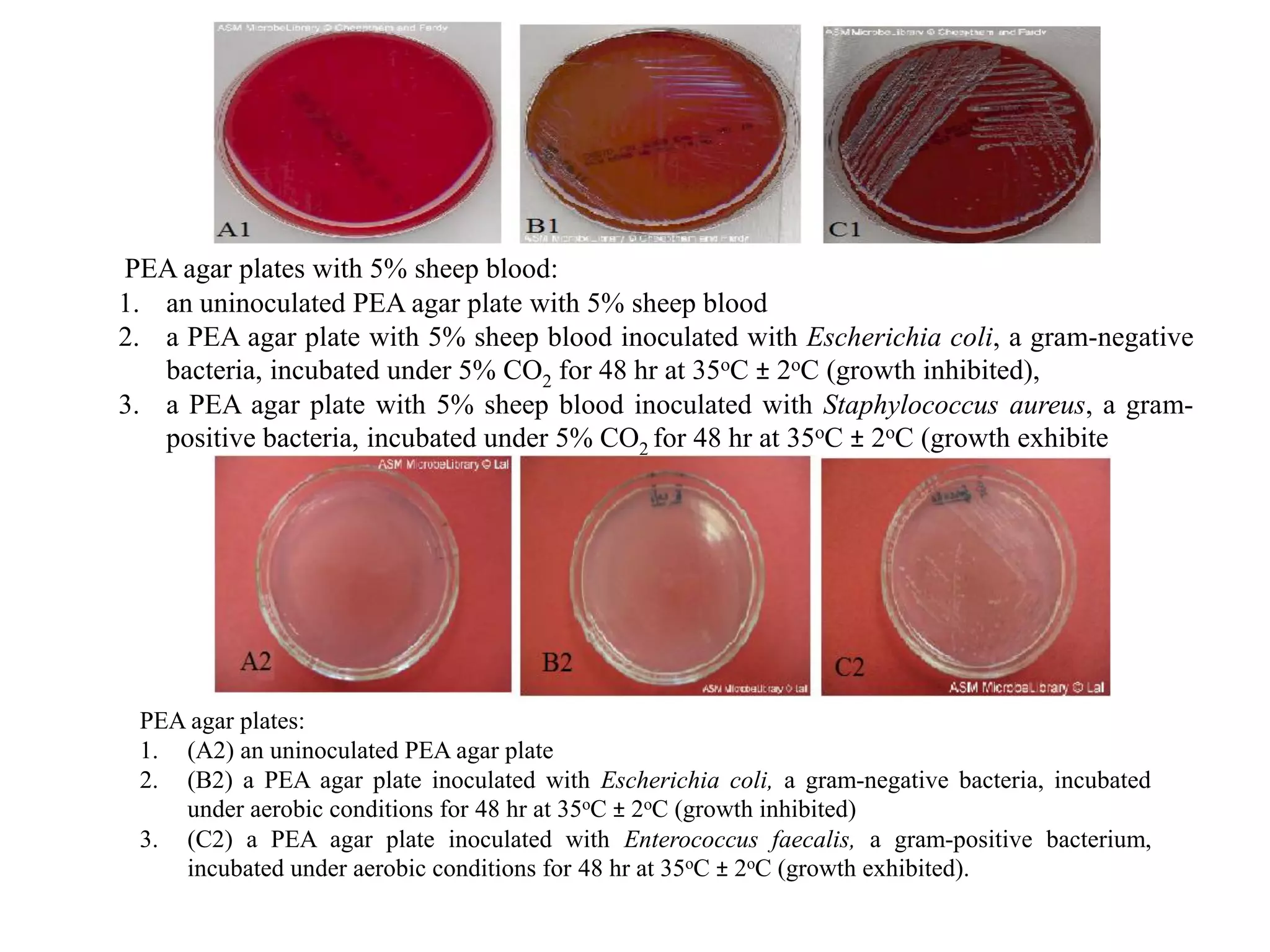 PEA agar plates with 5% sheep blood:
1. an uninoculated PEA agar plate with 5% sheep blood
2. a PEA agar plate with 5% sheep blood inoculated with Escherichia coli, a gram-negative
bacteria, incubated under 5% CO2 for 48 hr at 35oC ± 2oC (growth inhibited),
3. a PEA agar plate with 5% sheep blood inoculated with Staphylococcus aureus, a gram-
positive bacteria, incubated under 5% CO2 for 48 hr at 35oC ± 2oC (growth exhibite
PEA agar plates:
1. (A2) an uninoculated PEA agar plate
2. (B2) a PEA agar plate inoculated with Escherichia coli, a gram-negative bacteria, incubated
under aerobic conditions for 48 hr at 35oC ± 2oC (growth inhibited)
3. (C2) a PEA agar plate inoculated with Enterococcus faecalis, a gram-positive bacterium,
incubated under aerobic conditions for 48 hr at 35oC ± 2oC (growth exhibited).﻿
 