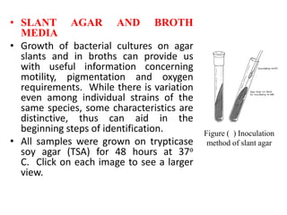 • SLANT AGAR AND BROTH
MEDIA
• Growth of bacterial cultures on agar
slants and in broths can provide us
with useful information concerning
motility, pigmentation and oxygen
requirements. While there is variation
even among individual strains of the
same species, some characteristics are
distinctive, thus can aid in the
beginning steps of identification.
• All samples were grown on trypticase
soy agar (TSA) for 48 hours at 37o
C. Click on each image to see a larger
view.
Figure ( ) Inoculation
method of slant agar
 