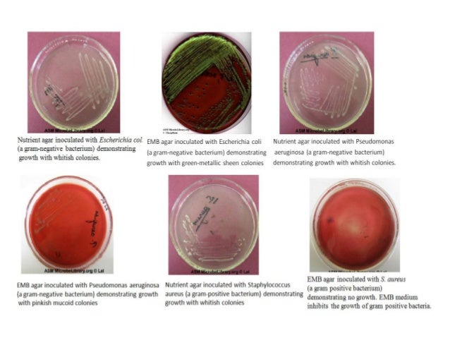 Compare The Recipes Of Nutrient Agar And Emb Agar If An ...