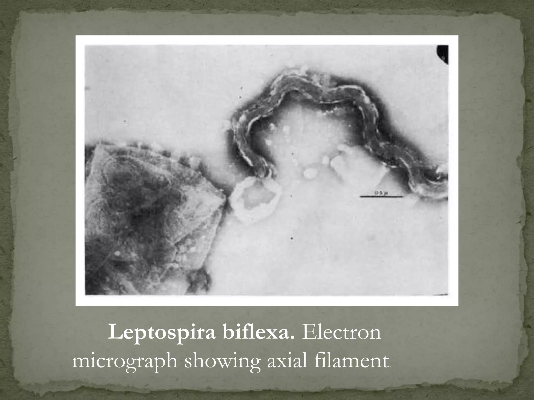 Leptospira biflexa. Electron
micrograph showing axial filament.
 