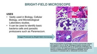 BRIGHT-FIELD MICROSCOPE
USES
• Vastly used in Biology, Cellular
Biology, and Microbiological
Laboratory studies.
• It can be used to identify basic
bacteria cells and parasitic
protozoans such as Paramecium.
Image Produced by Bright-field microscopy
Bone marrow biopsies of cynomolgus monkeys experimentally infected
with hepatitis E virus at 160 dpi. Histological analysis showing: (A-B)
vacuolization in mononuclear cells (!); (C) lymphocyte proliferation and
activation clusters; (D) megakaryocytosis (>5 megakaryocytes/field); (E)
absence of megakaryocytosis (0-2 megakaryocytes/field); and (F)
vacuolization in endosteal cells (!). Hematoxilin and Eosin stain.
 