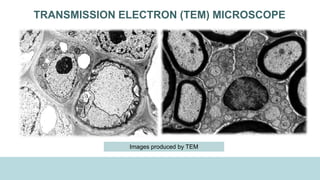 TRANSMISSION ELECTRON (TEM) MICROSCOPE
Images produced by TEM
 