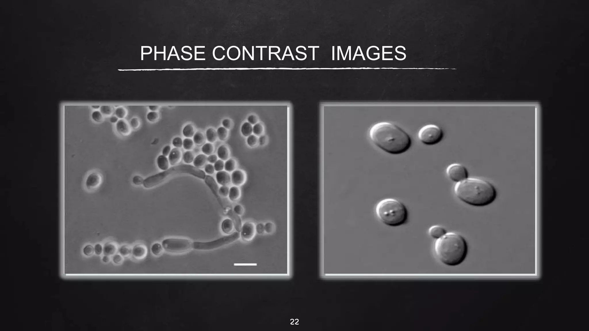 22
PHASE CONTRAST IMAGES
 