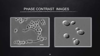 22
PHASE CONTRAST IMAGES
 
