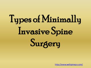 Types of Minimally
Invasive Spine
Surgery
http://www.wellspinepa.com/

 