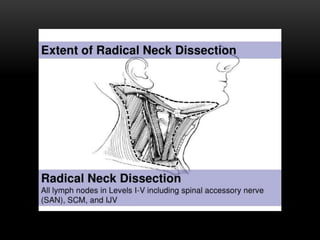 Types of neck dissection | PPTX