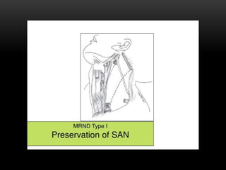 Types of neck dissection | PPTX