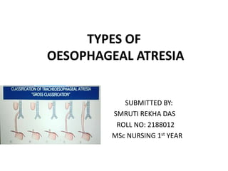 TYPES OF
OESOPHAGEAL ATRESIA
SUBMITTED BY:
SMRUTI REKHA DAS
ROLL NO: 2188012
MSc NURSING 1st YEAR
 