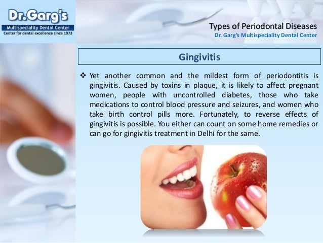 Types of Periodontal Diseases