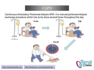 CAPD
http://renalcareindia.org http://facebook.com/renalcareindia
Continuous Ambulatory Peritoneal dialysis APD- It is manual peritoneal dialysis
exchange procedure which has to be done several times throughout the day
 