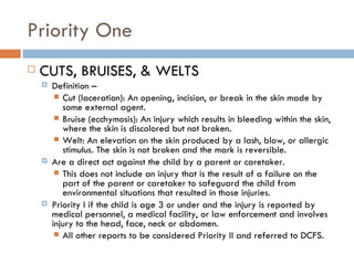 Child Physical Abuse | PPT