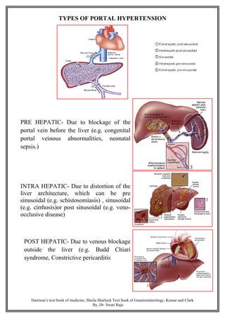TYPES OF PORTAL HYPERTENSION
PRE HEPATIC- Due to blockage of the
portal vein before the liver (e.g. congenital
portal veinous abnormalities, neonatal
sepsis.)
INTRA HEPATIC- Due to distortion of the
liver architecture, which can be pre
sinusoidal (e.g. schistosomiasis) , sinusoidal
(e.g. cirrhosis)or post sinusoidal (e.g. veno-
occlusive disease)
POST HEPATIC- Due to venous blockage
outside the liver (e.g. Budd Chiari
syndrome, Constrictive pericarditis
Harrison’s text book of medicine, Sheila Sherlock Text book of Gasteroenterology, Kumar and Clark
By, Dr. Swati Raju
 