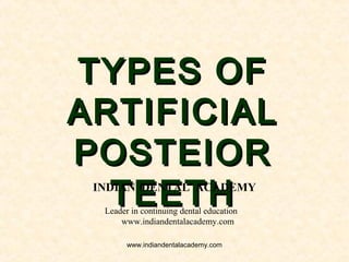 TYPES OFTYPES OF
ARTIFICIALARTIFICIAL
POSTEIORPOSTEIOR
TEETHTEETHINDIAN DENTAL ACADEMY
Leader in continuing dental education
www.indiandentalacademy.com
www.indiandentalacademy.com
 