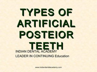 TYPES OFTYPES OF
ARTIFICIALARTIFICIAL
POSTEIORPOSTEIOR
TEETHTEETHINDIAN DENTAL ACADEMY
LEADER IN CONTINUING Education
www.indiandentalacademy.com
 