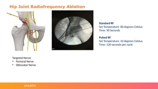 Types of Radiofrequency Ablation Procedures (Avanos).pptx