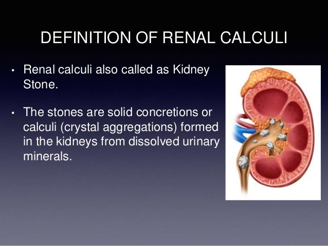 TYPES OF RENAL CALCULI