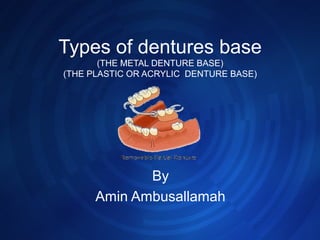 Types of dentures base
(THE METAL DENTURE BASE)
(THE PLASTIC OR ACRYLIC DENTURE BASE)
By
Amin Ambusallamah
 
