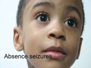 Absence seizures
 