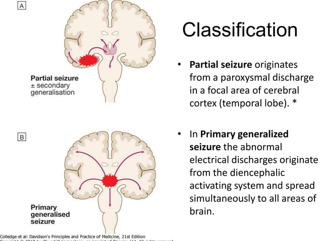 Types of Seizure | PPTX | Brain and Nervous System Disorders | Diseases ...