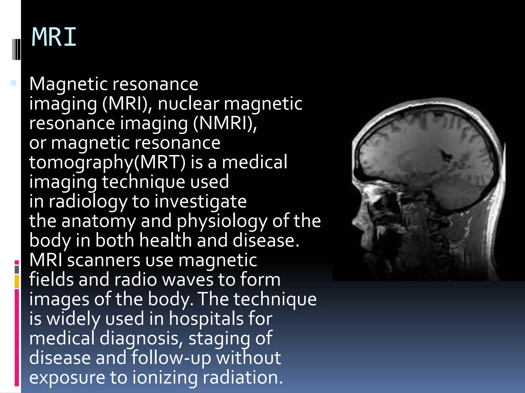 MRI
 Magnetic resonance
imaging (MRI), nuclear magnetic
resonance imaging (NMRI),
or magnetic resonance
tomography(MRT) is a medical
imaging technique used
in radiology to investigate
the anatomy and physiology of the
body in both health and disease.
MRI scanners use magnetic
fields and radio waves to form
images of the body.The technique
is widely used in hospitals for
medical diagnosis, staging of
disease and follow-up without
exposure to ionizing radiation.
 