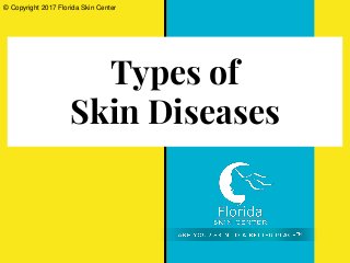 Types of
Skin Diseases
© Copyright 2017 Florida Skin Center
 