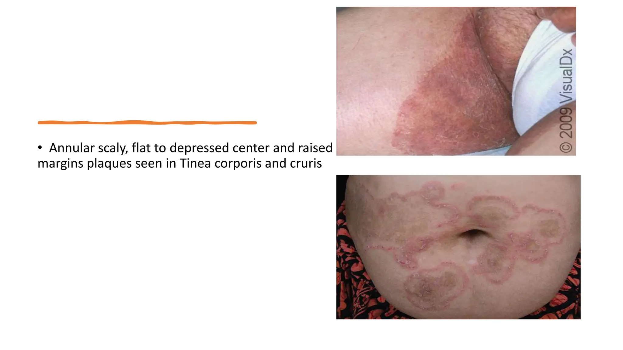 Clinical Classification of Skin Lesions: A Morphological Approach in ...