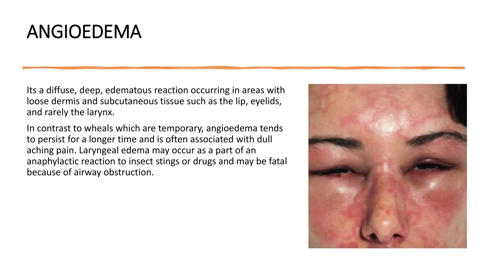 Clinical Classification Of Skin Lesions A Morphological Approach In 