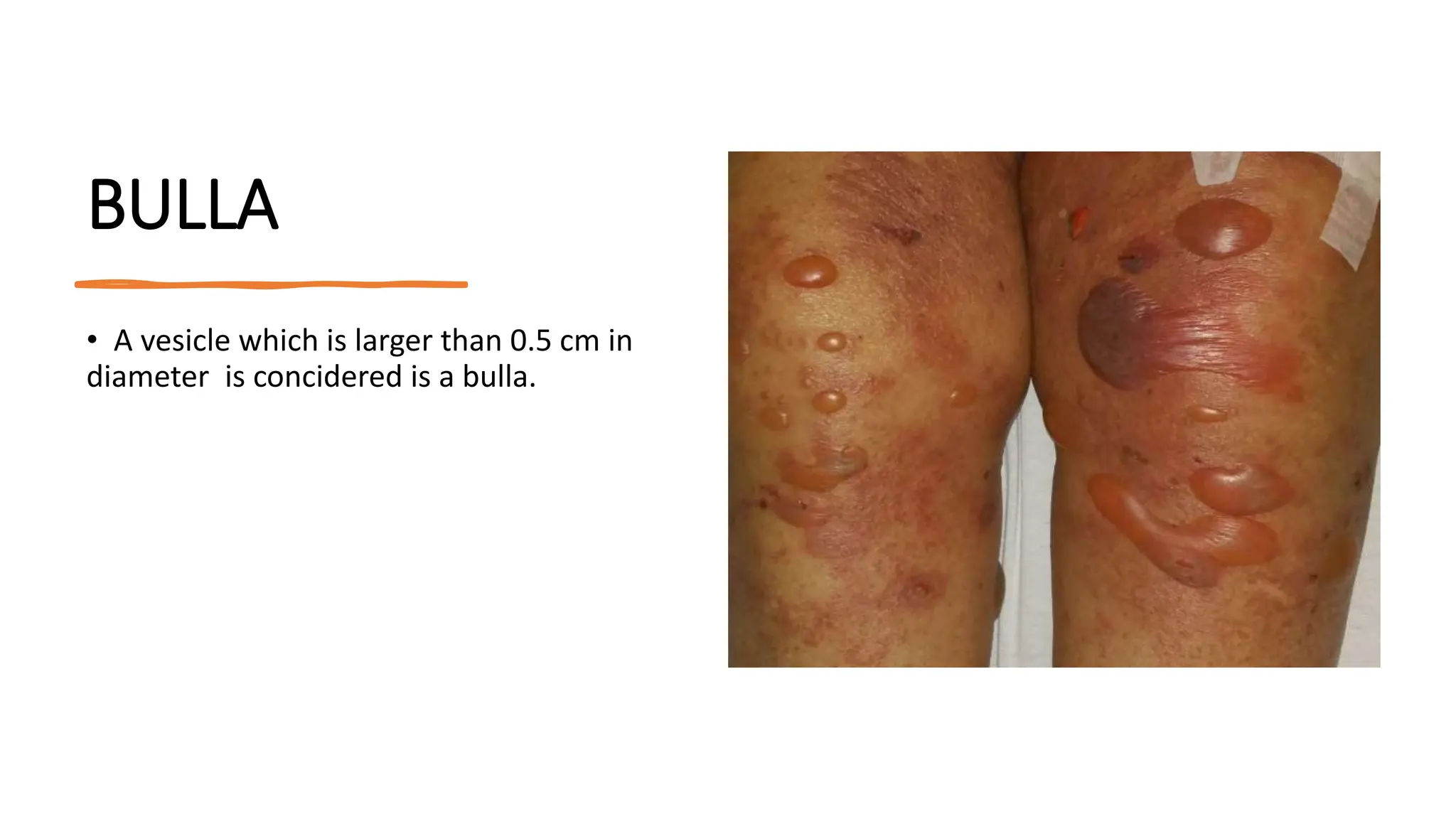 Clinical Classification of Skin Lesions: A Morphological Approach in ...