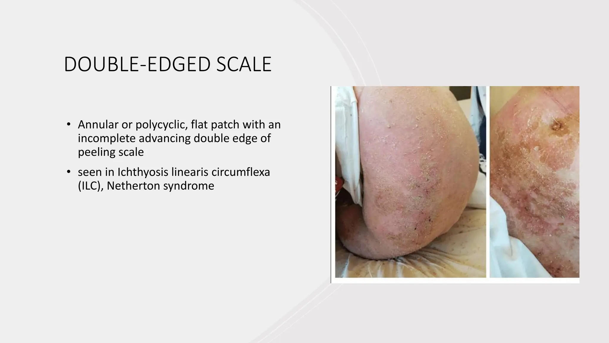 Clinical Classification of Skin Lesions: A Morphological Approach in ...