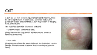 Clinical Classification of Skin Lesions: A Morphological Approach in ...
