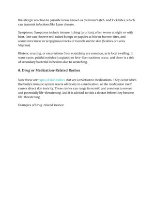 Tunning Track Rash Types of Skin Rashes Signaling Hormonal, Allergic, or Infectious ...