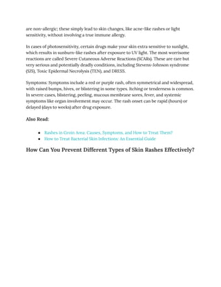 Types of Skin Rashes Signaling Hormonal, Allergic, or Infectious ...