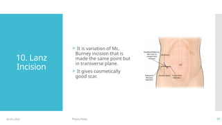Surgical incision (Physiotherapy) (General Surgical Incision) | PPTX