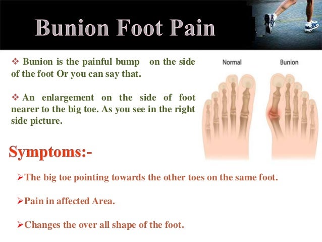 Foot Pain Symptom Chart