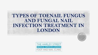 TYPES OF TOENAIL FUNGUS
AND FUNGAL NAIL
INFECTION TREATMENT IN
LONDON
 