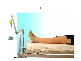 Compression Traction Signe Virtual Sign Identification of Traction Types in Medical Surgical ...