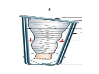 Compression Traction Signe Virtual Sign Identification of Traction Types in Medical Surgical ...