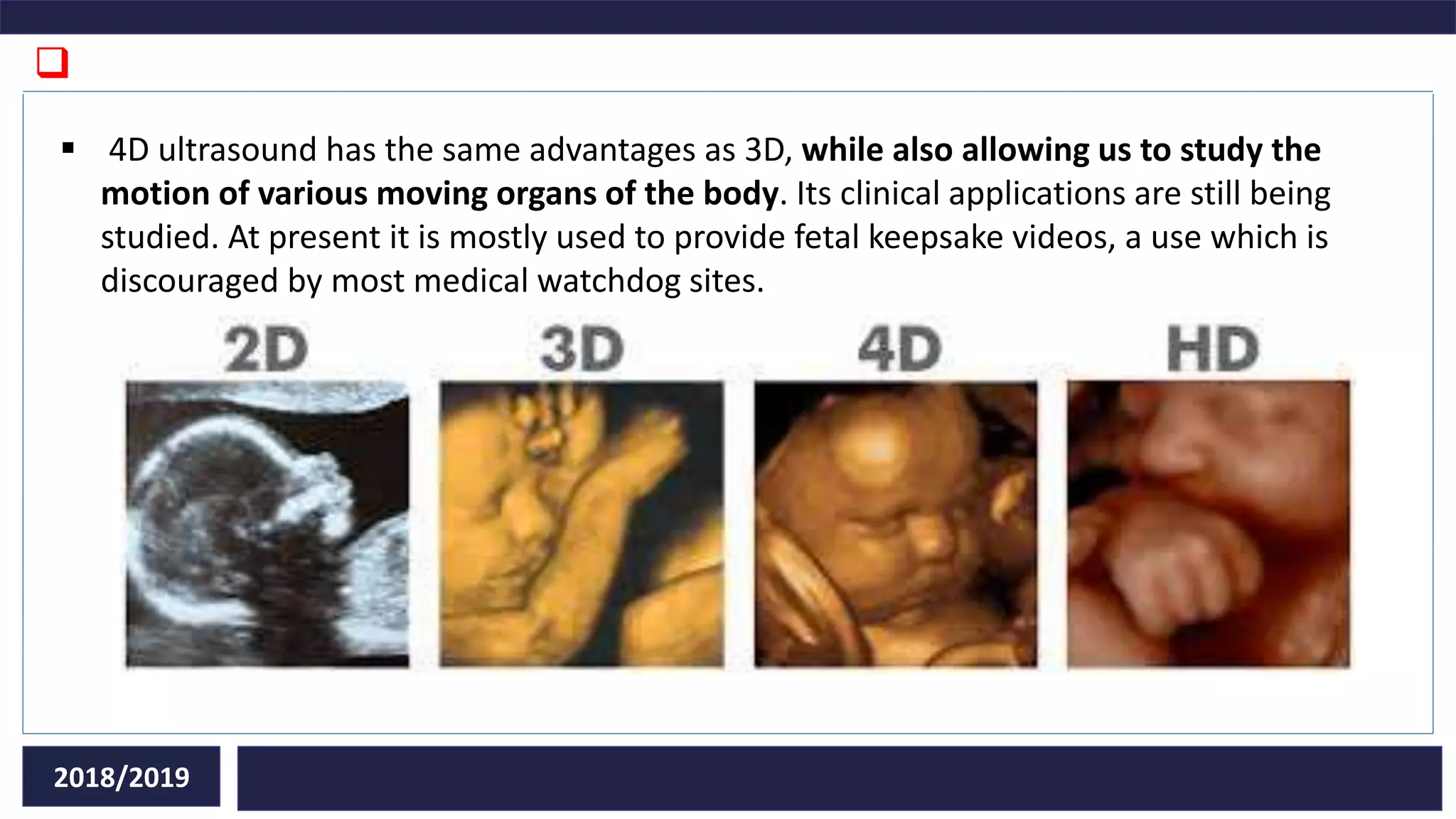 Types of transducers in ultrasound diagnostic PPT