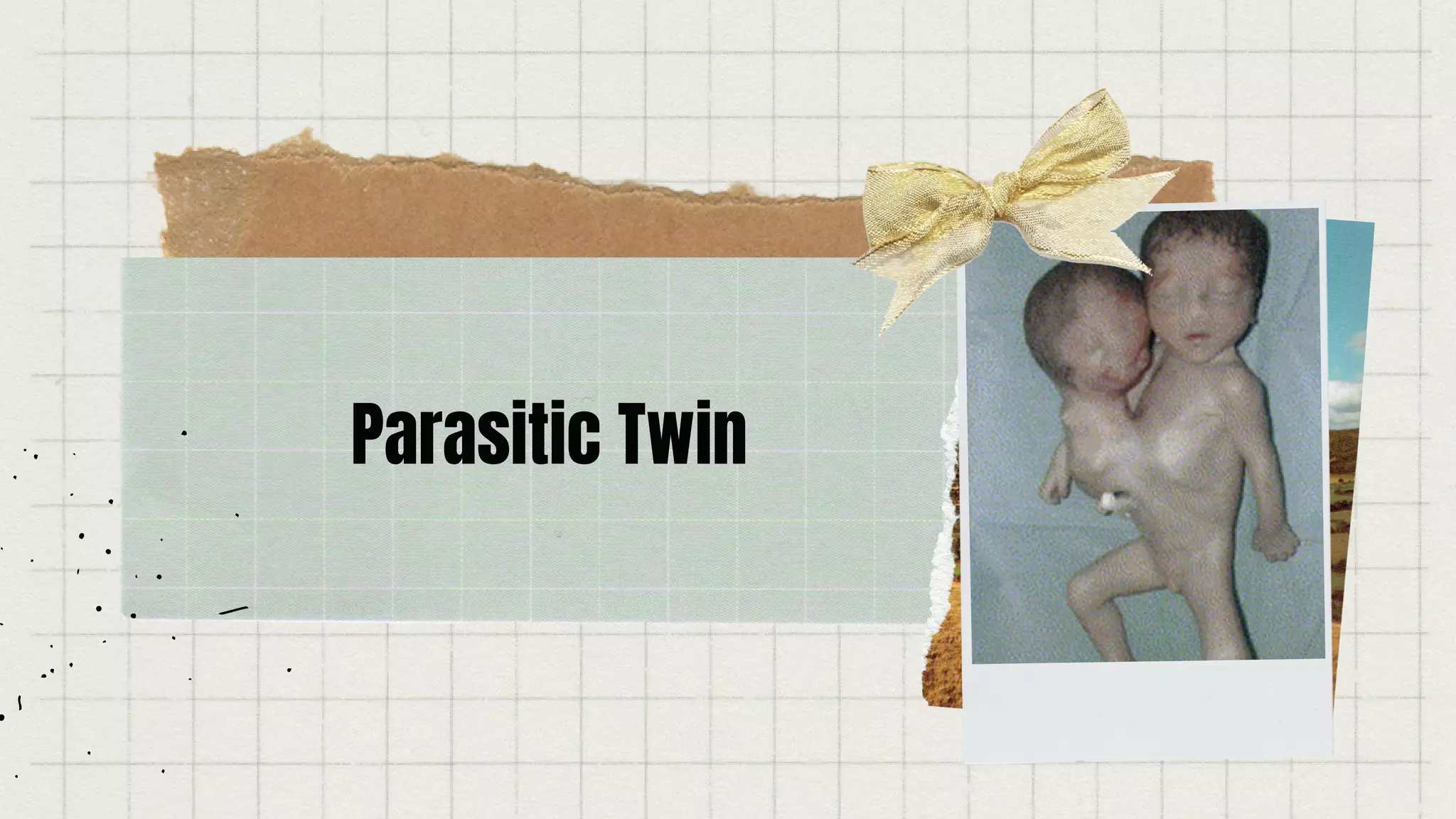 Parasitic Twin
 