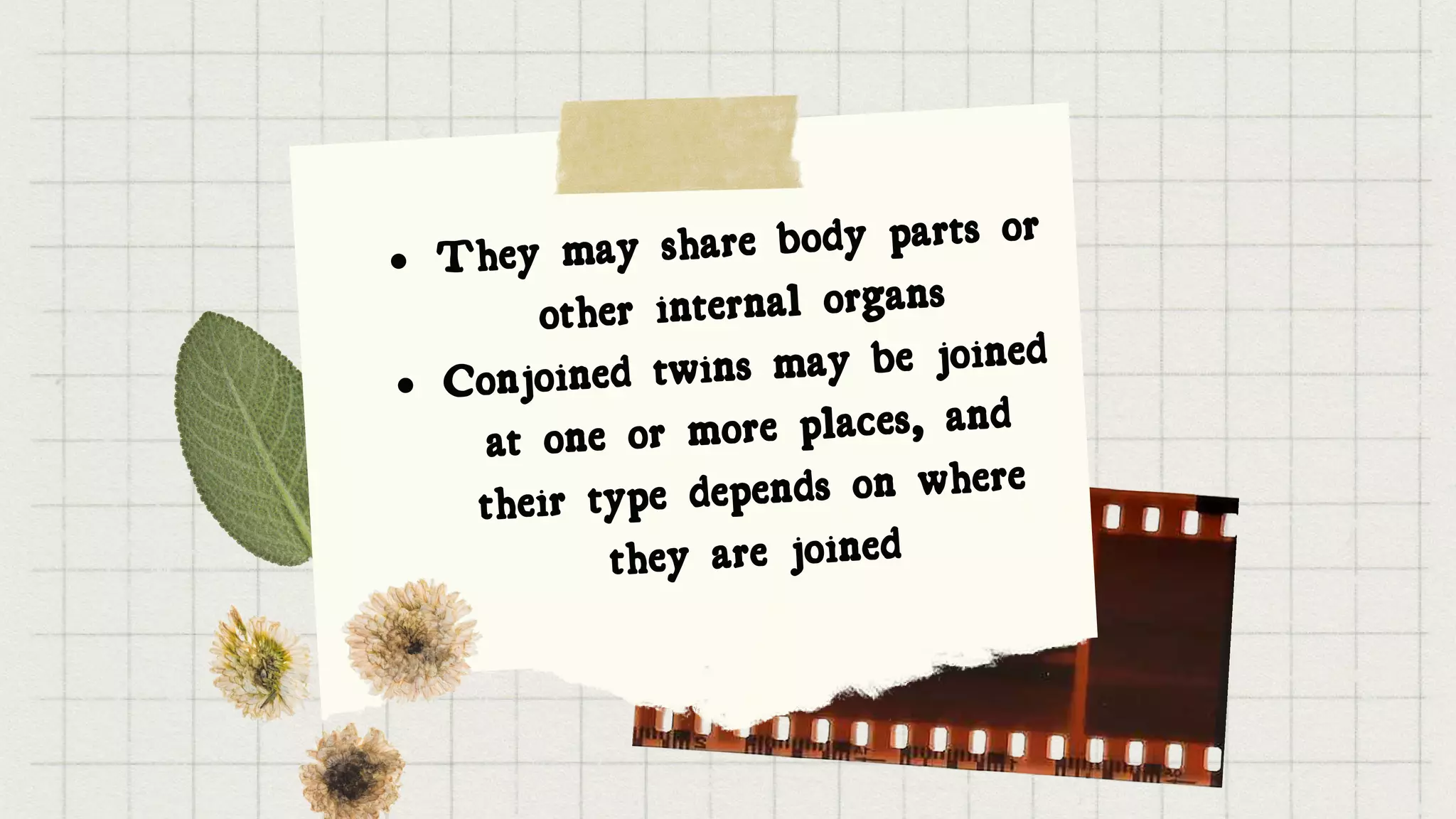 They may share body parts or
other internal organs
Conjoined twins may be joined
at one or more places, and
their type depends on where
they are joined


 