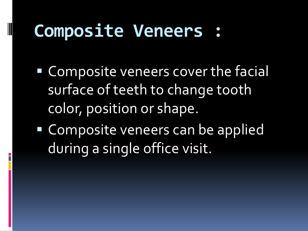 Types of veneers