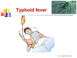 Dr. Upadhyaya
Typhoid fever
 