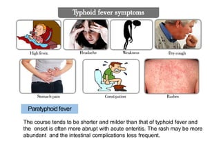 Paratyphoid fever
The course tends to be shorter and milder than that of typhoid fever and
the onset is often more abrupt with acute enteritis. The rash may be more
abundant and the intestinal complications less frequent.
 
