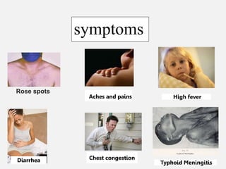 Rose spots
High fever
Diarrhea Typhoid Meningitis
Aches and pains
Chest congestion
symptoms
 