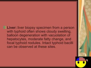 Liver:  liver biopsy specimen from a person with typhoid often shows cloudy swelling, balloon degeneration with vacuolation of hepatocytes, moderate fatty change, and focal typhoid nodules. Intact typhoid bacilli can be observed at these sites.  