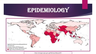 https://images.app.goo.gl/9r4hv6aJf4Qux67R7
Epidemiology
 