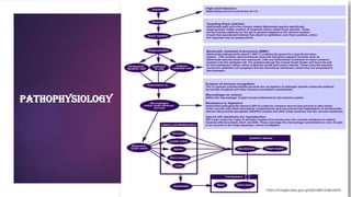 Pathophysiology
https://images.app.goo.gl/q5hmjRkJZuBsLx6HA
 