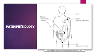 Pathophysiology
https://www.ncbi.nlm.nih.gov/books/NBK8435/bin/ch21f1.jpg
 